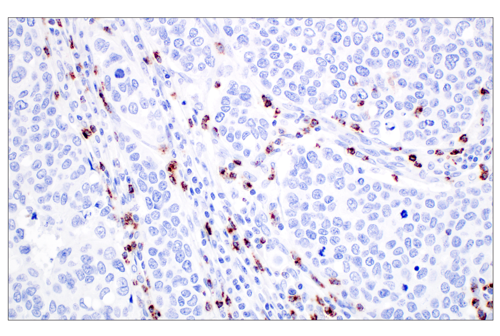 Immunohistochemistry Image 2: NKG7 (F4V5I) Rabbit mAb