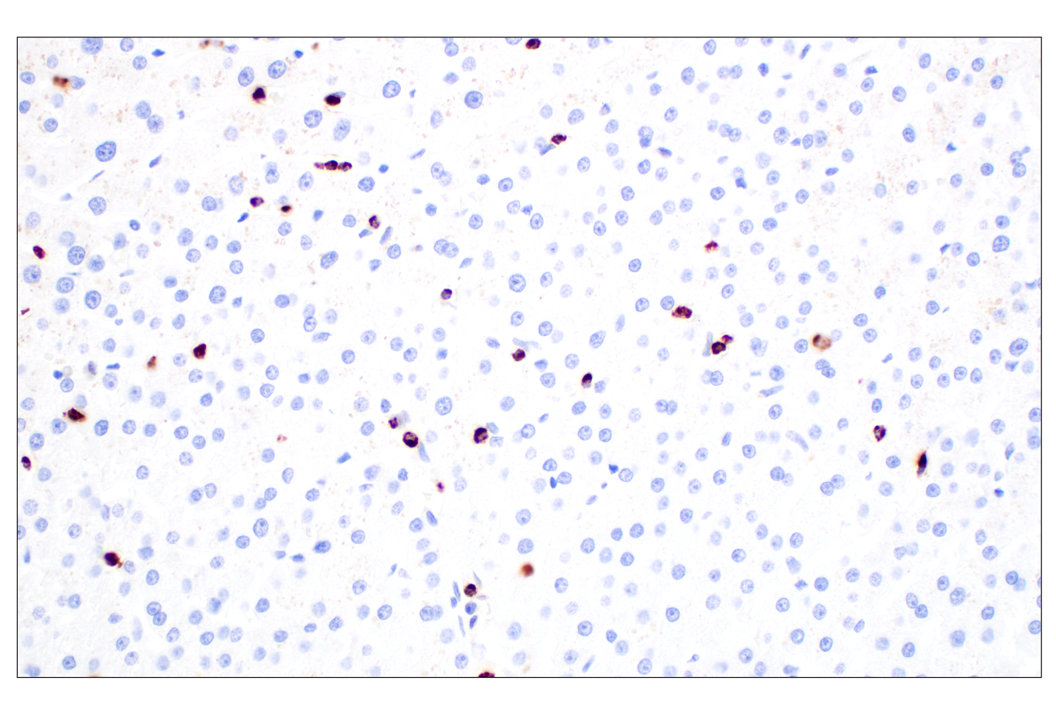 Immunohistochemistry Image 8: NKG7 (F4V5I) Rabbit mAb