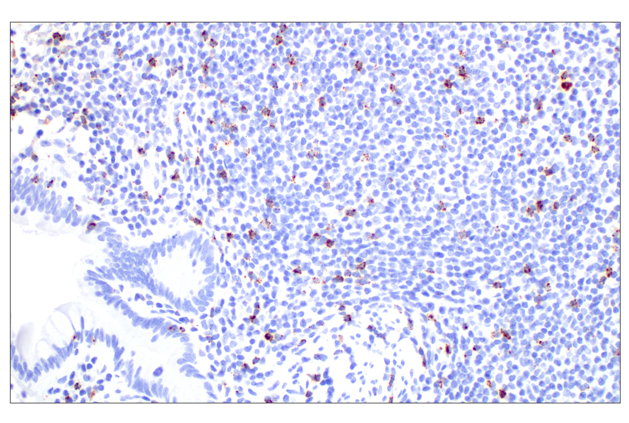 Immunohistochemistry Image 6: NKG7 (F4V5I) Rabbit mAb