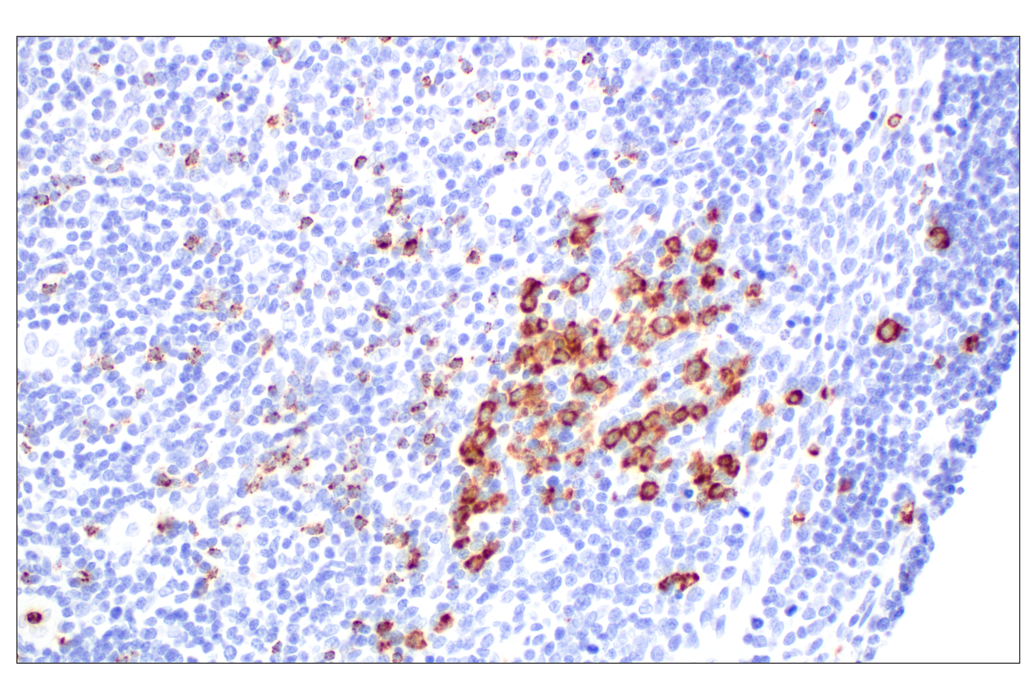Immunohistochemistry Image 9: NKG7 (F4V5I) Rabbit mAb