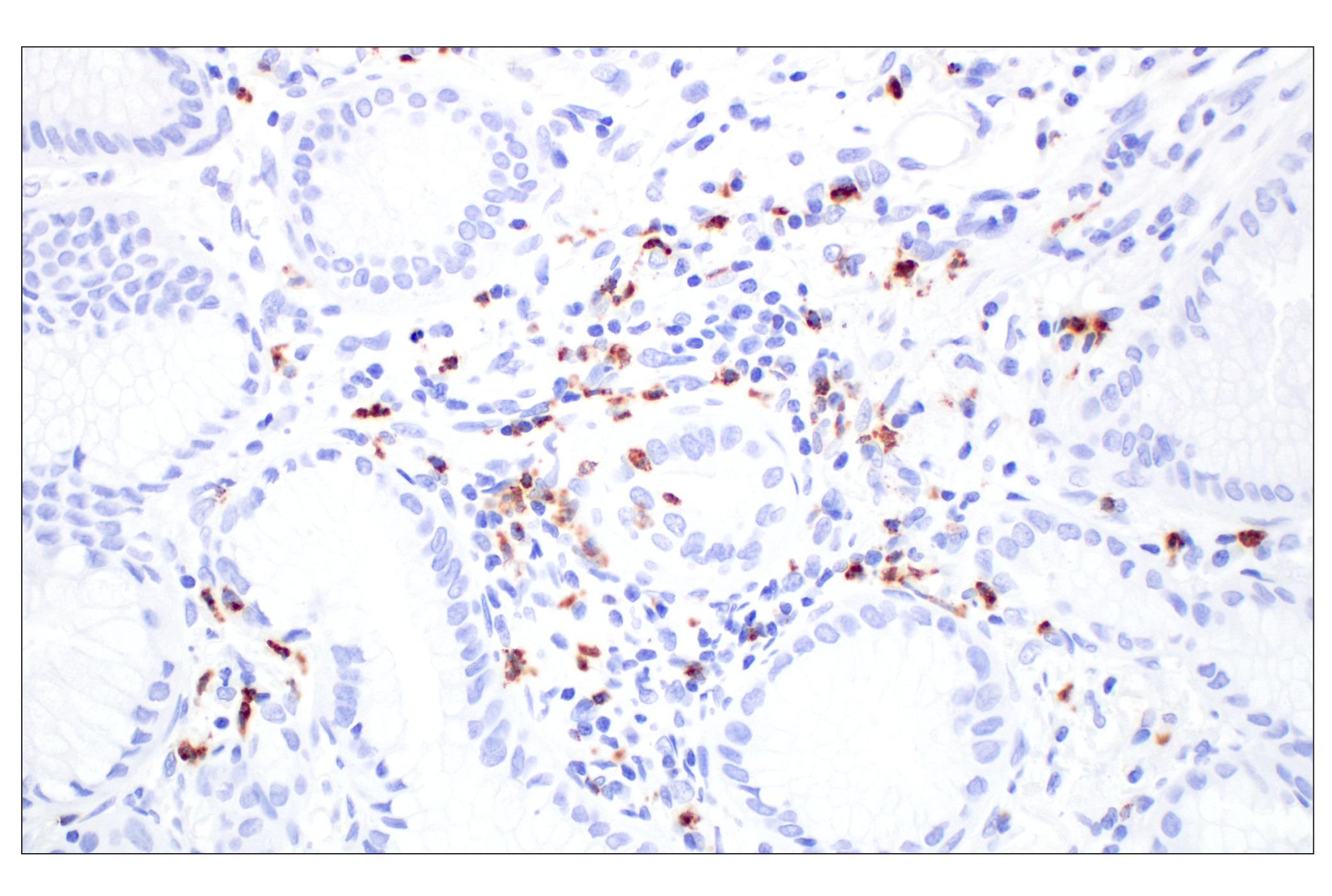 Immunohistochemistry Image 3: NKG7 (F4V5I) Rabbit mAb