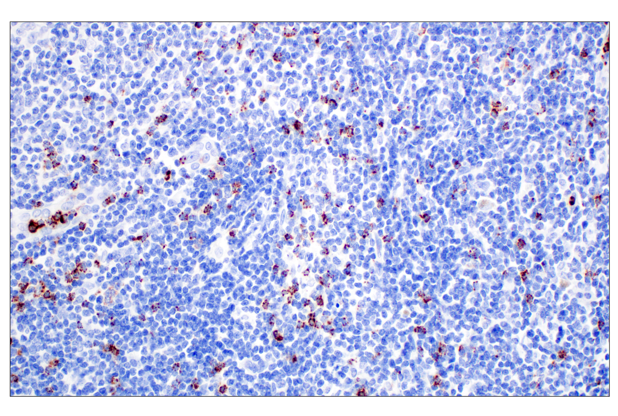 Immunohistochemistry Image 1: NKG7 (F4V5I) Rabbit mAb