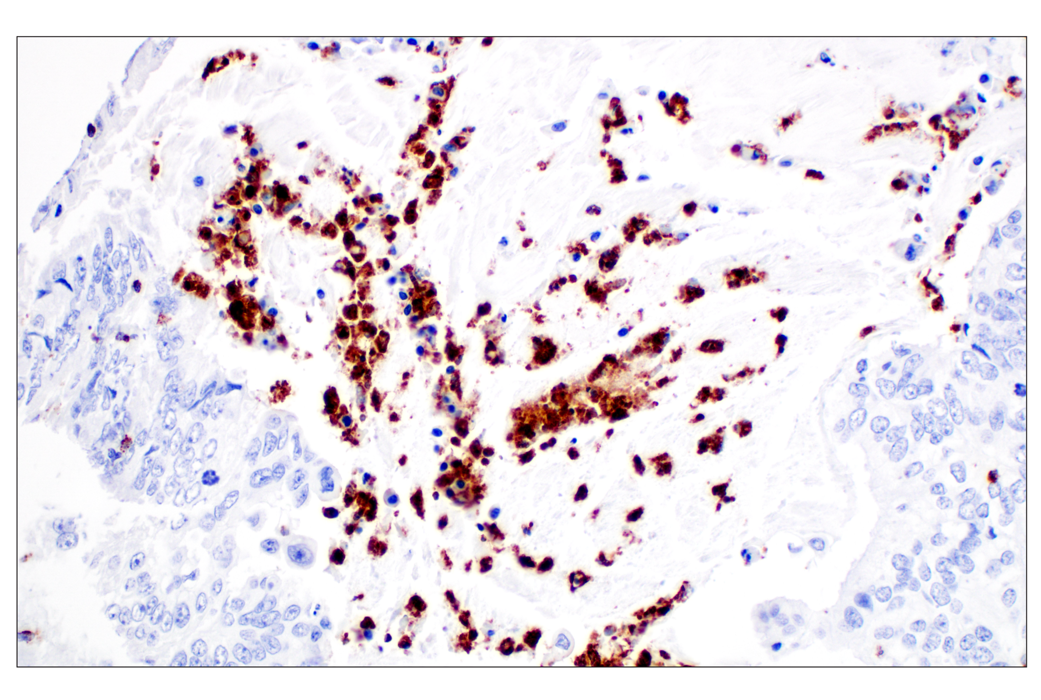 Immunohistochemistry Image 5: NKG7 (F4V5I) Rabbit mAb