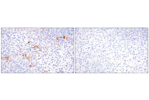 Immunohistochemistry Image 5: iNOS (E1W4J) Rabbit mAb (BSA and Azide Free)