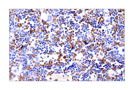 Immunohistochemistry Image 2: S100A8 (E4F8V) XP® Rabbit mAb (BSA and Azide Free)