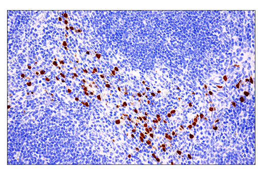 Immunohistochemistry Image 1: S100A8 (E4F8V) XP® Rabbit mAb (BSA and Azide Free)