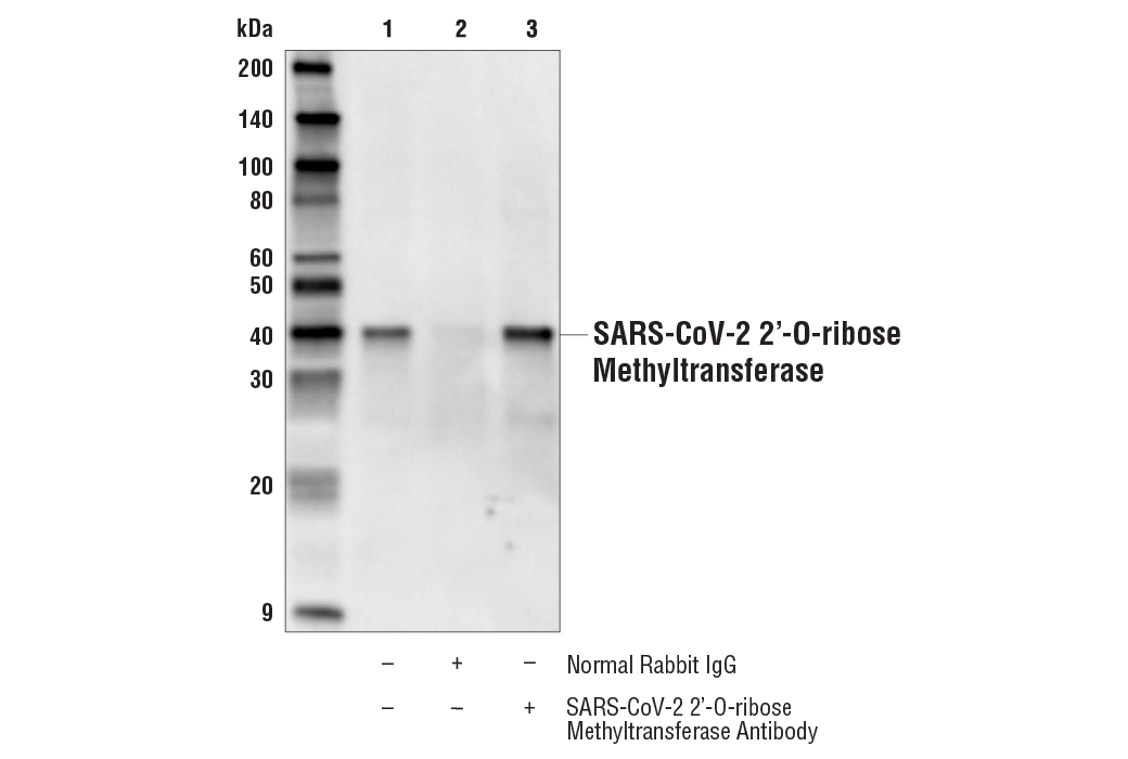 Immunoprecipitation Image 1: SARS-CoV-2 2'-O-ribose Methyltransferase Antibody