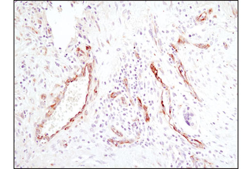Immunohistochemistry Image 2: SPARC (D10F10) Rabbit mAb (BSA and Azide Free)