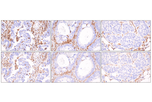 Immunohistochemistry Image 2: SLP-76 (D1R1A) Rabbit mAb