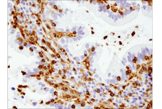 Immunohistochemistry Image 3: SLP-76 (D1R1A) Rabbit mAb (BSA and Azide Free)