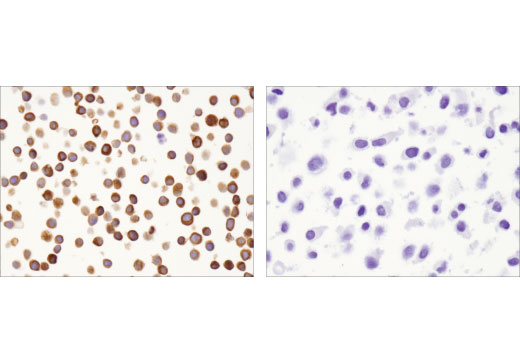 Immunohistochemistry Image 1: SLP-76 (D1R1A) Rabbit mAb (BSA and Azide Free)