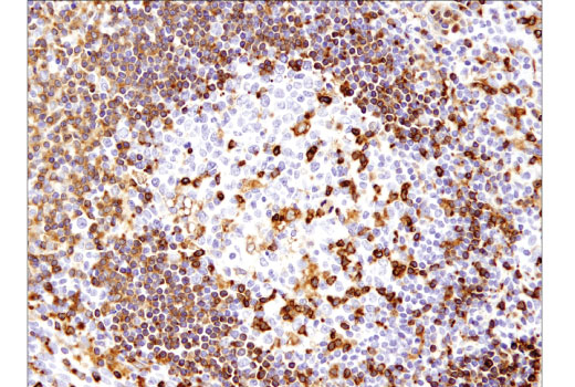 Immunohistochemistry Image 2: SLP-76 (D1R1A) Rabbit mAb (BSA and Azide Free)
