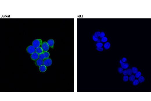 Immunofluorescence Image 1: SLP-76 (D1R1A) Rabbit mAb (BSA and Azide Free)