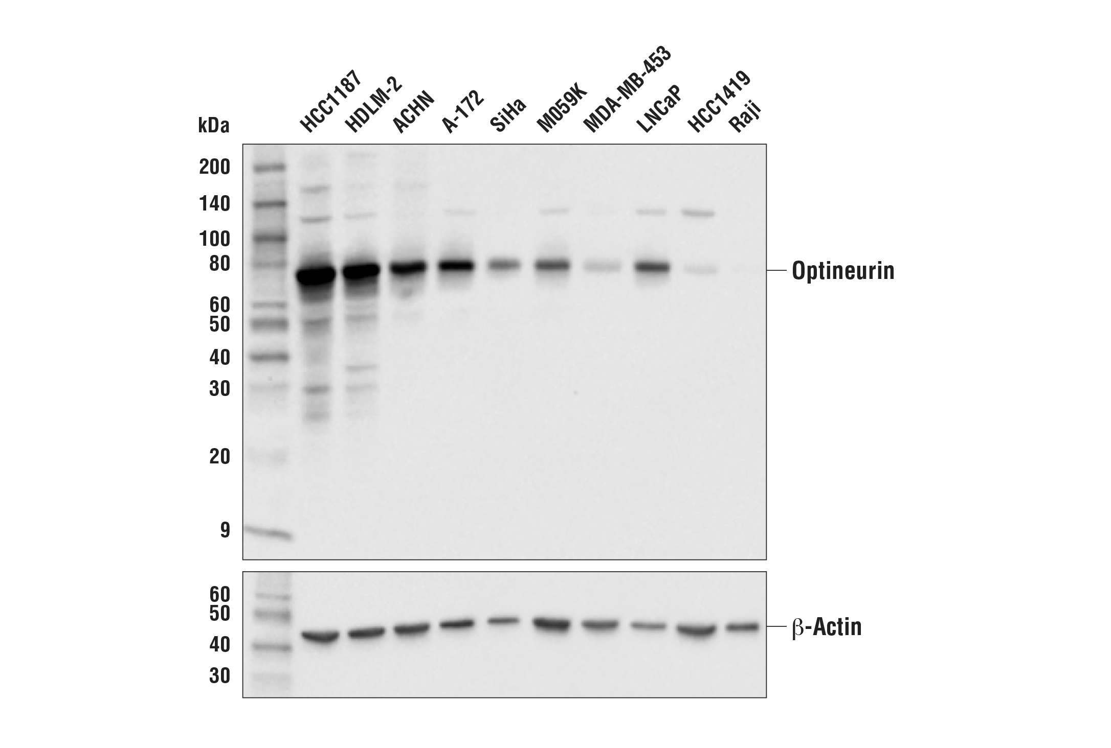 Image 2: PhosphoPlus® Optineurin (Ser177) Antibody Duet