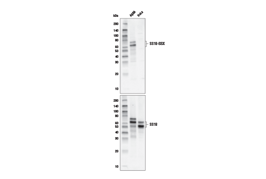 Western Blotting Image 1: SS18-SSX Antibody