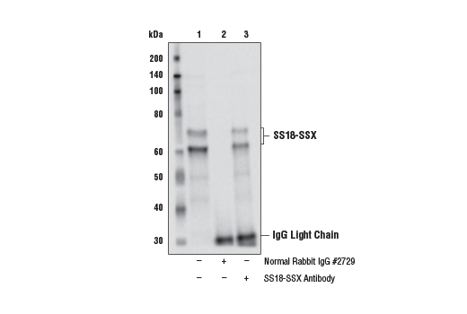 Immunoprecipitation Image 1: SS18-SSX Antibody
