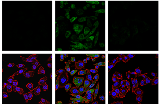 Immunofluorescence Image 1: Phospho-Ubiquitin (Ser65) (E5T1W) Rabbit mAb