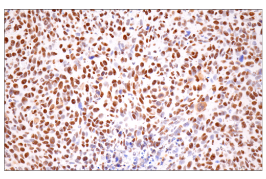 Immunohistochemistry Image 11: CPSF4 (E2L2Z) Rabbit mAb