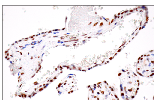 Immunohistochemistry Image 7: CPSF4 (E2L2Z) Rabbit mAb