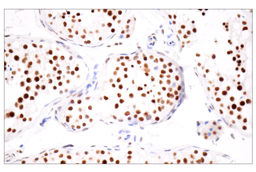 Immunohistochemistry Image 8: CPSF4 (E2L2Z) Rabbit mAb