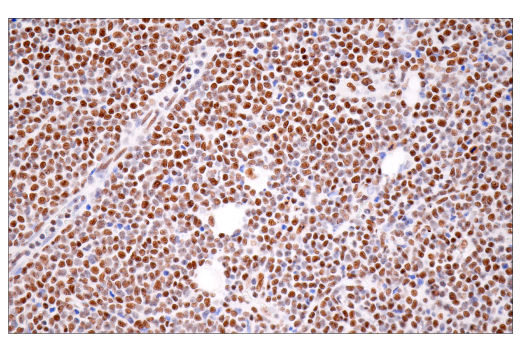 Immunohistochemistry Image 5: CPSF4 (E2L2Z) Rabbit mAb