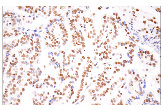 Immunohistochemistry Image 3: CPSF4 (E2L2Z) Rabbit mAb