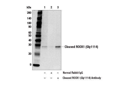 Immunoprecipitation Image 1: Cleaved ROCK1 (Gly1114) Antibody
