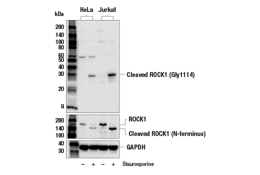 Western Blotting Image 1: Cleaved ROCK1 (Gly1114) Antibody
