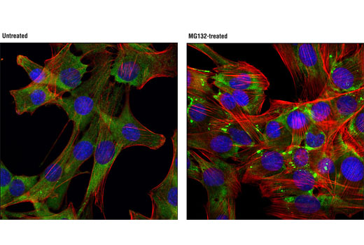 Immunofluorescence Image 1: FMRP (D14F4) Rabbit mAb