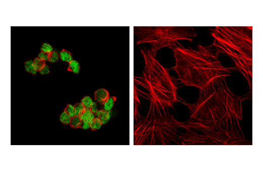 Immunofluorescence Image 1: EOMES (D8D1R) Rabbit mAb (BSA and Azide Free)