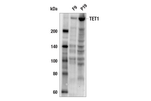  Image 3: Mouse Reactive DNA Demethylation Antibody Sampler Kit