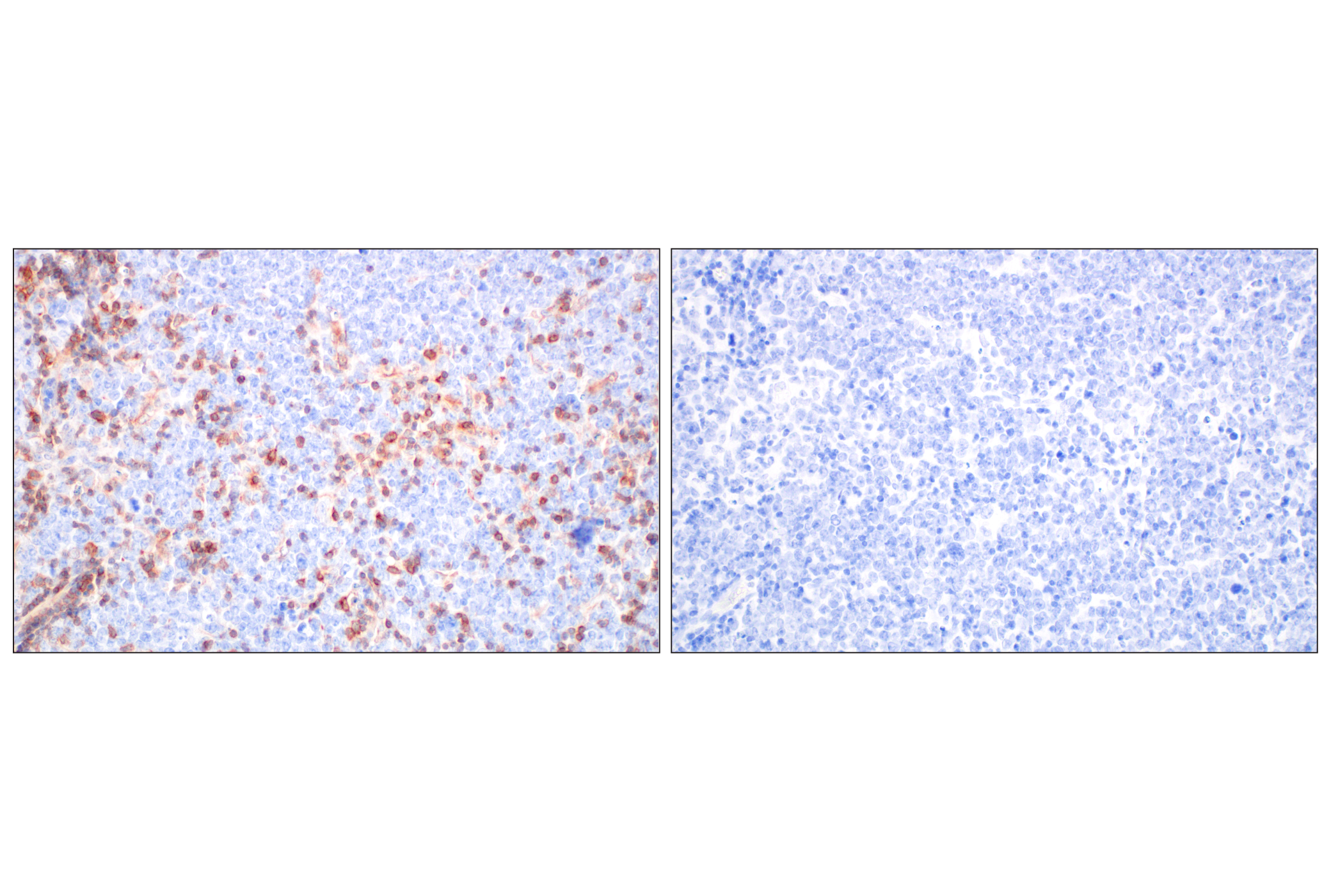 Immunohistochemistry Image 7: CD27 (F3R2V) Rabbit mAb