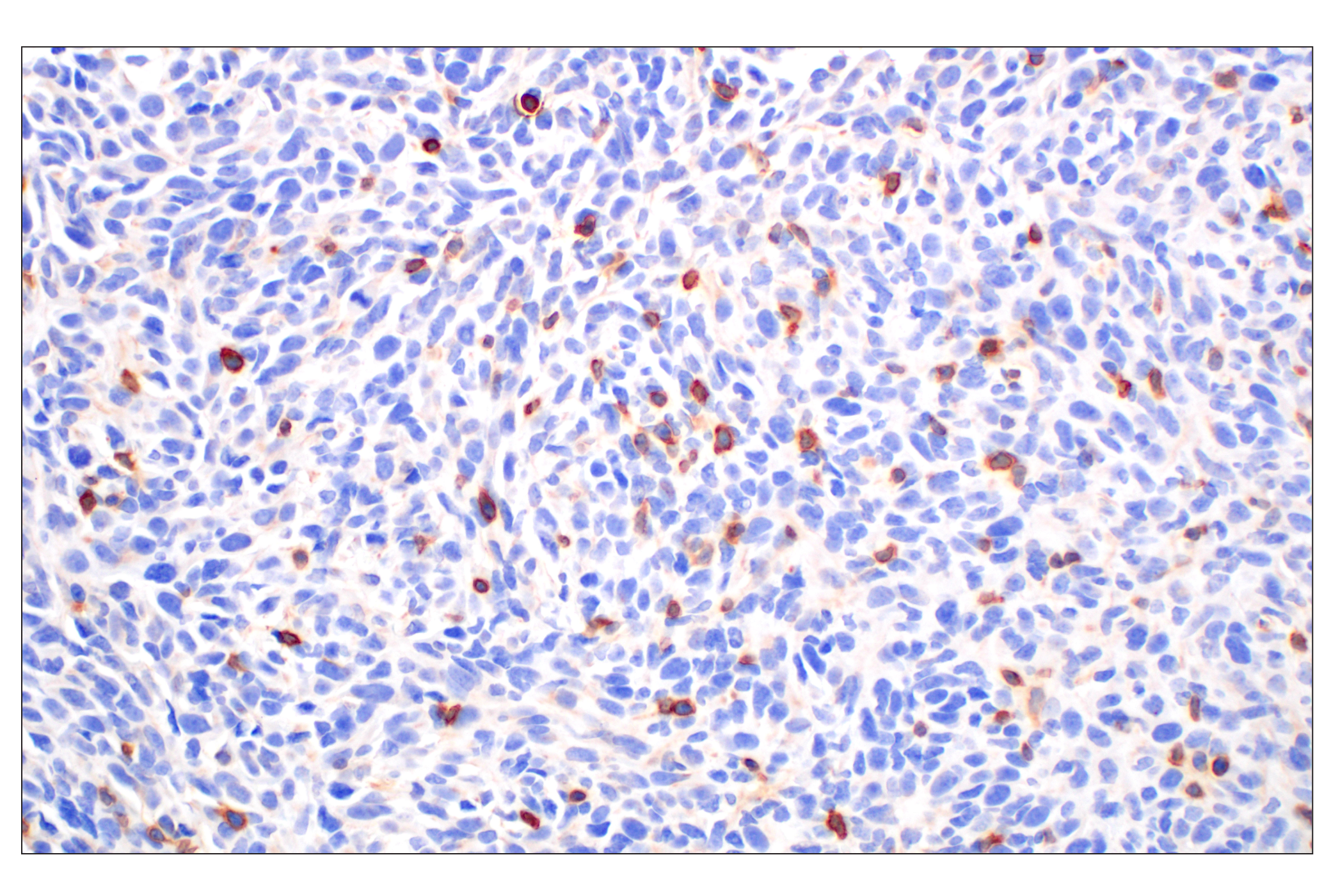 Immunohistochemistry Image 1: CD27 (F3R2V) Rabbit mAb