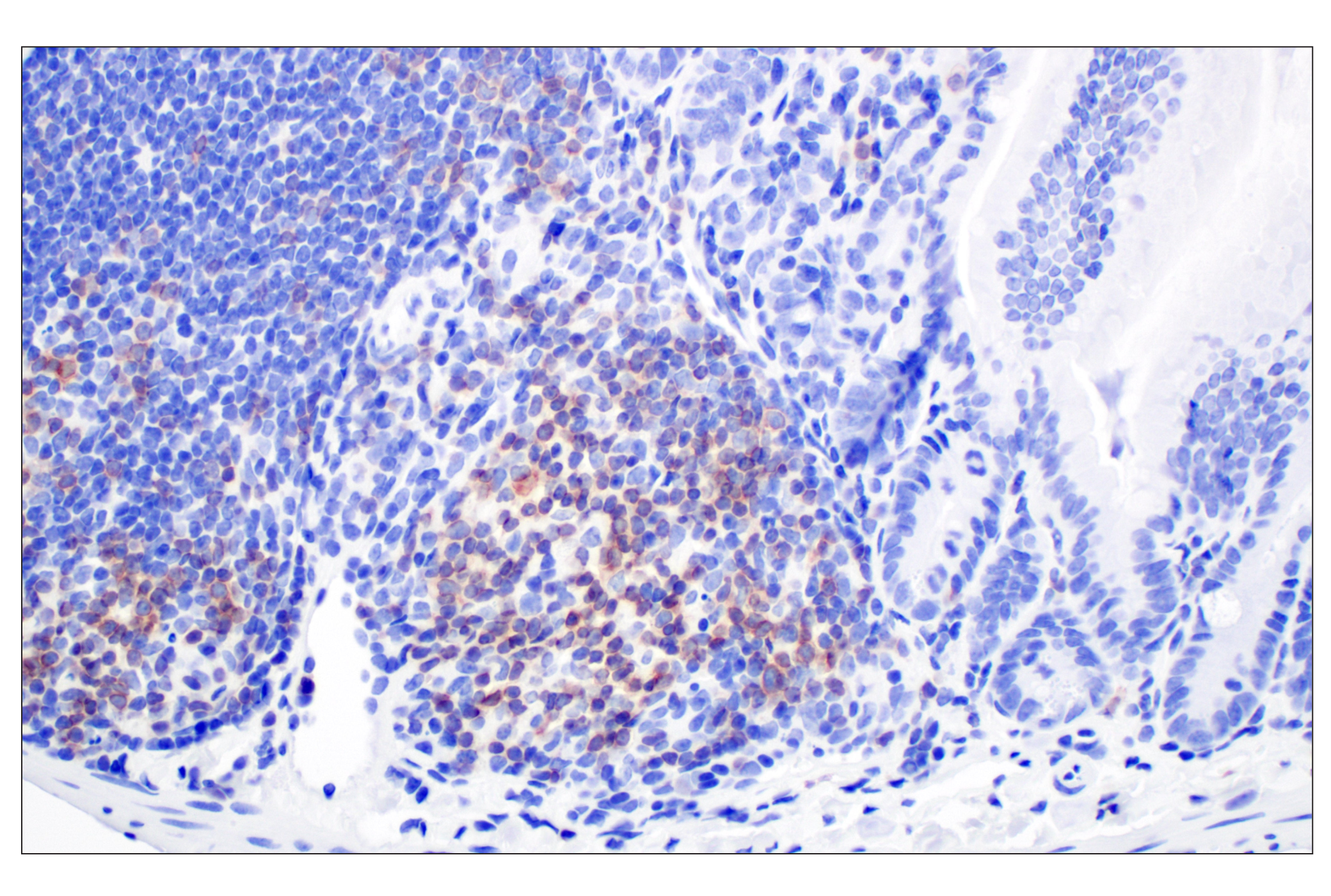 Immunohistochemistry Image 4: CD27 (F3R2V) Rabbit mAb