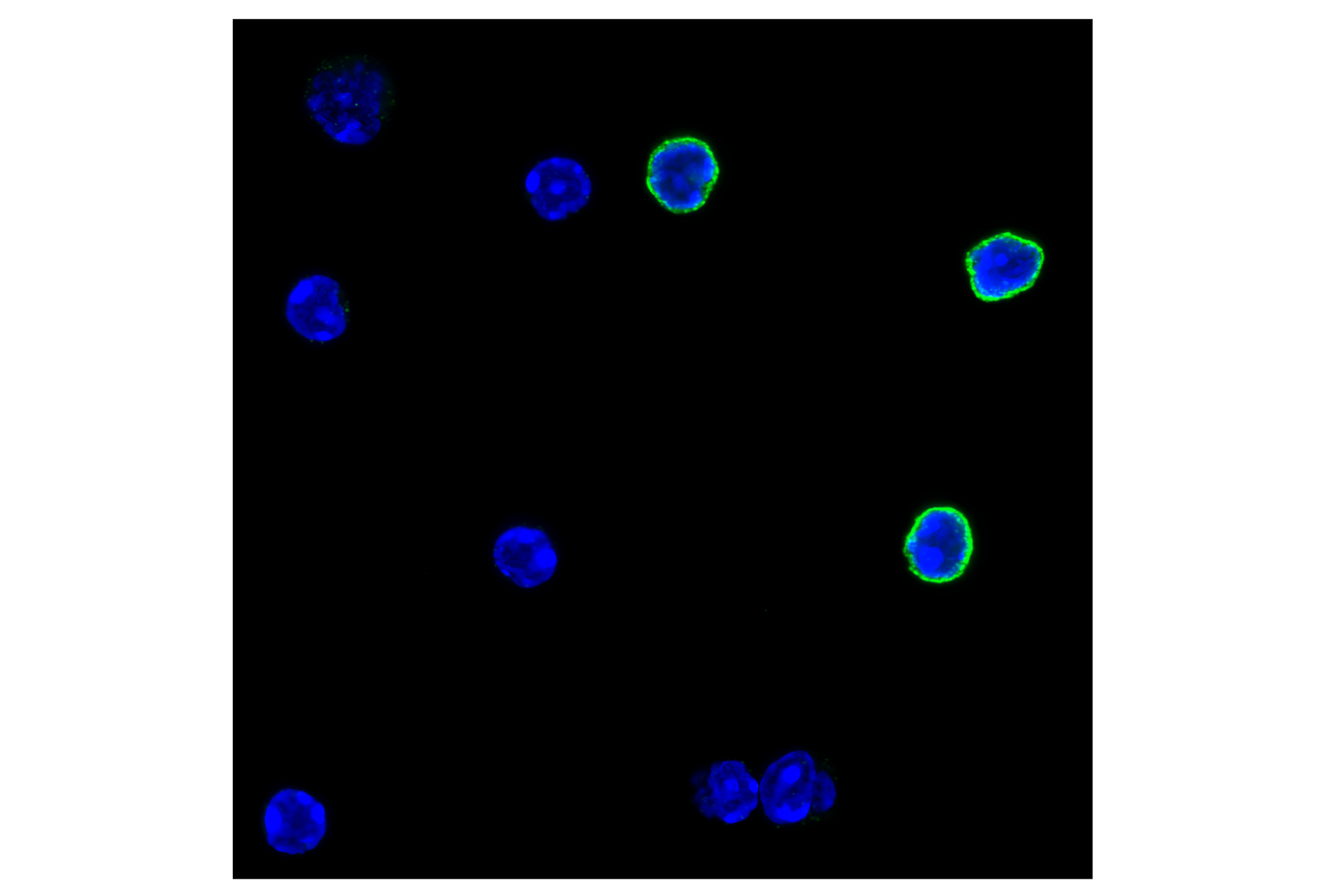 Immunofluorescence Image 4: CD27 (F3R2V) Rabbit mAb