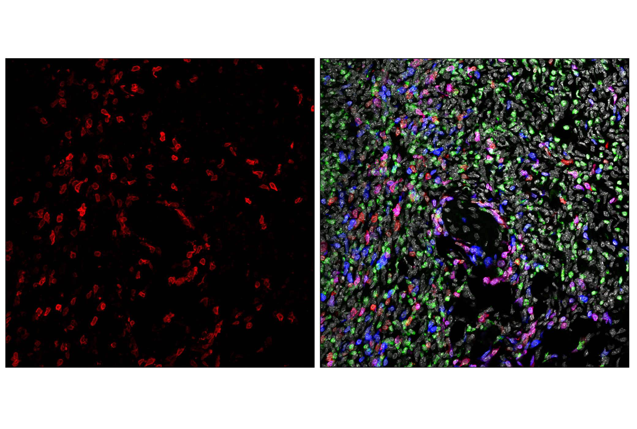 Immunofluorescence Image 1: CD27 (F3R2V) Rabbit mAb