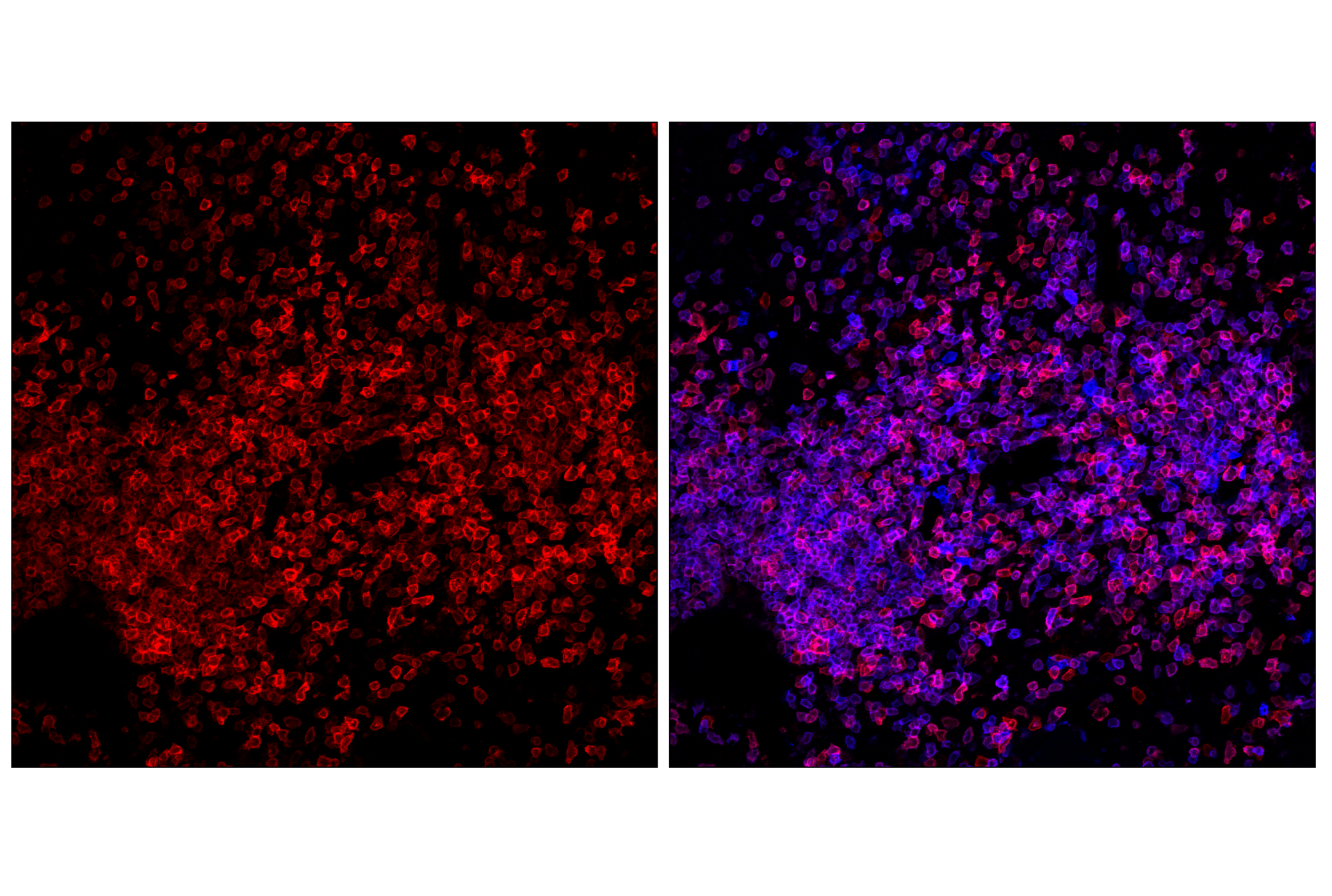 Immunofluorescence Image 2: CD27 (F3R2V) Rabbit mAb