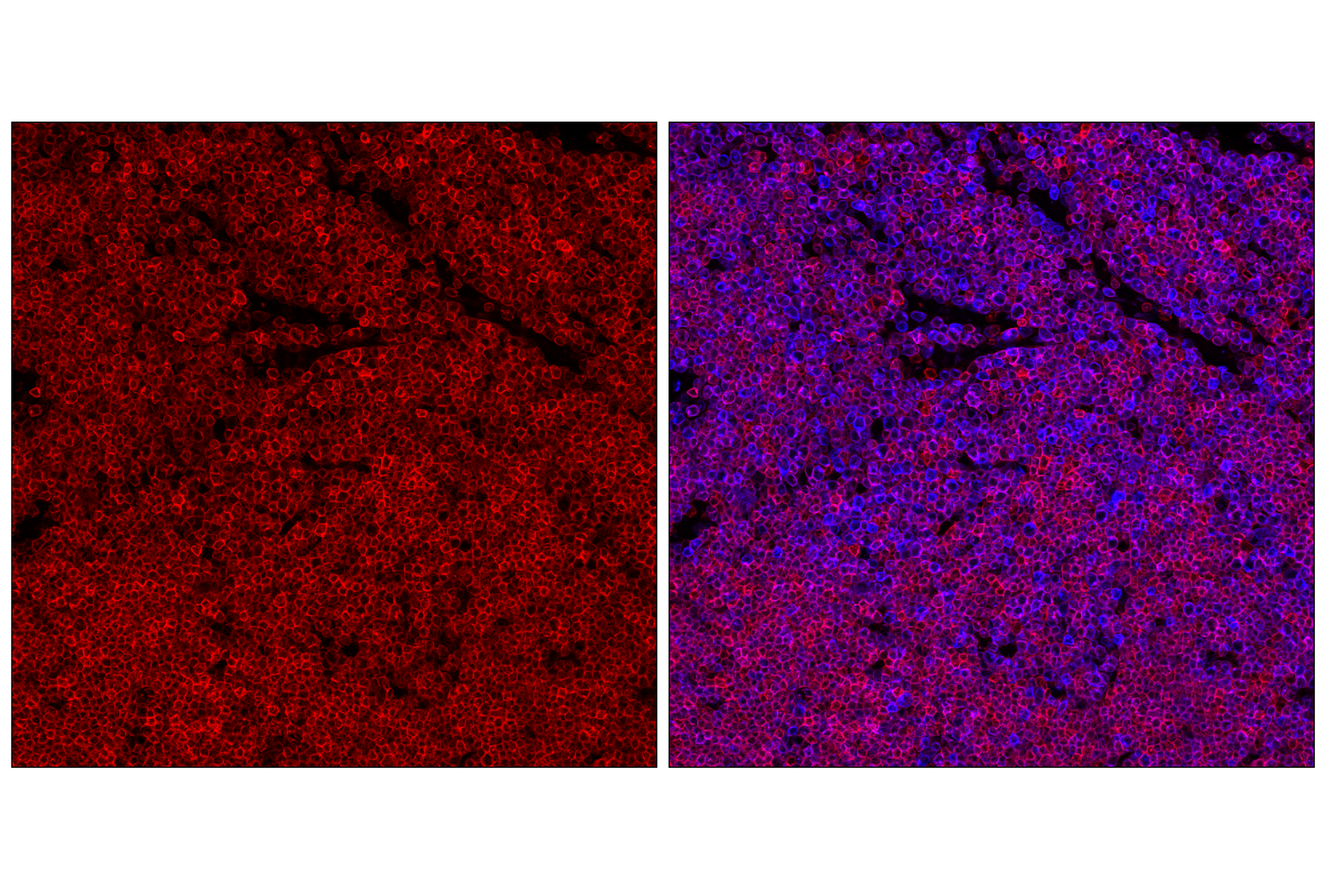 Immunofluorescence Image 3: CD27 (F3R2V) Rabbit mAb