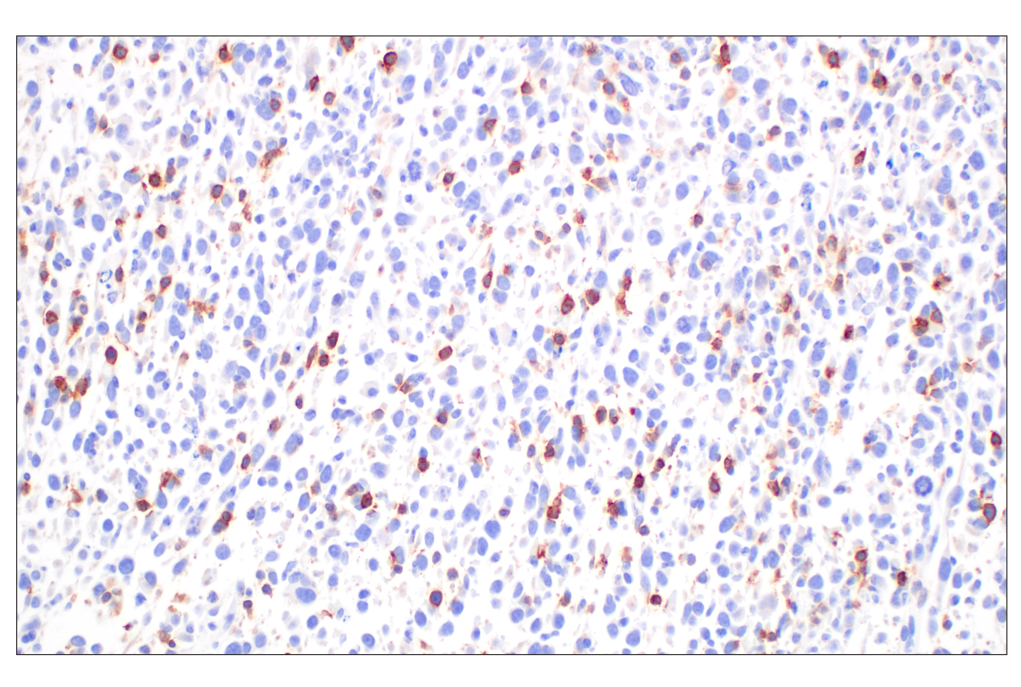 Immunohistochemistry Image 2: CD27 (F3R2V) Rabbit mAb