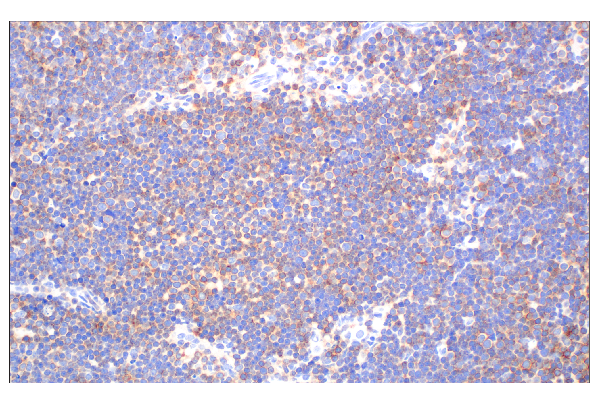 Immunohistochemistry Image 5: CD27 (F3R2V) Rabbit mAb