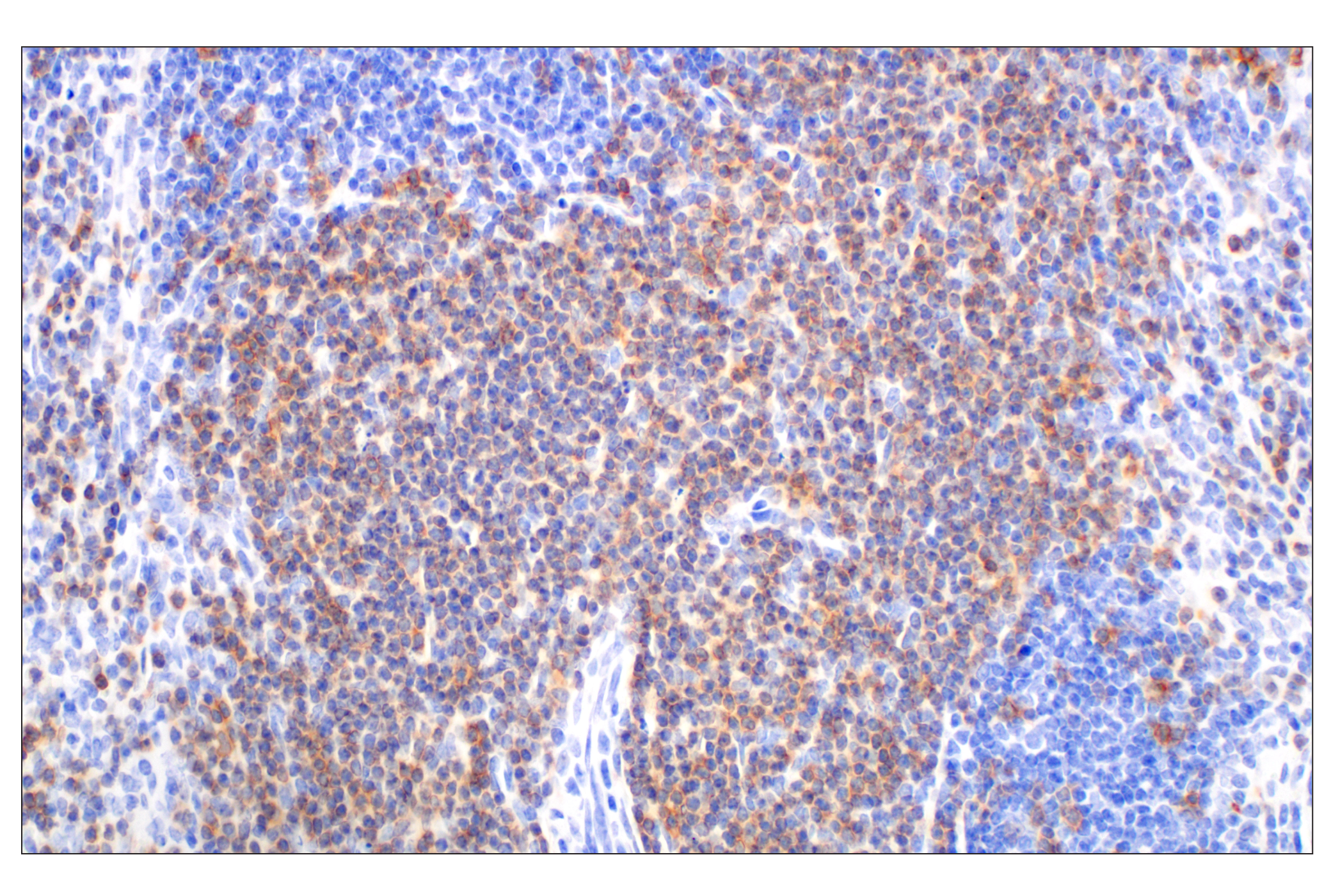 Immunohistochemistry Image 3: CD27 (F3R2V) Rabbit mAb