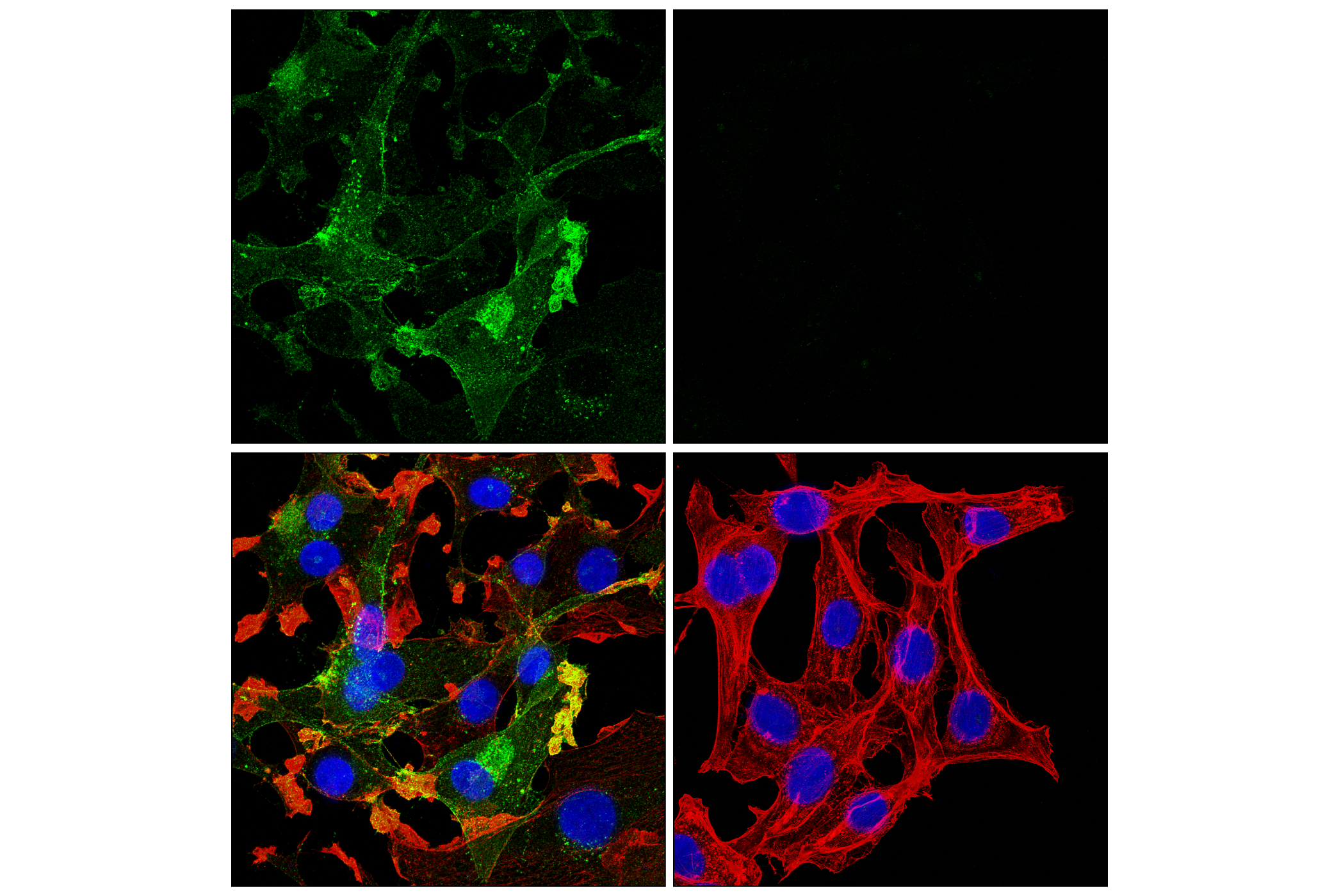 Immunofluorescence Image 1: Neuropilin-2 (E5Q2G) Rabbit mAb (BSA and Azide Free)