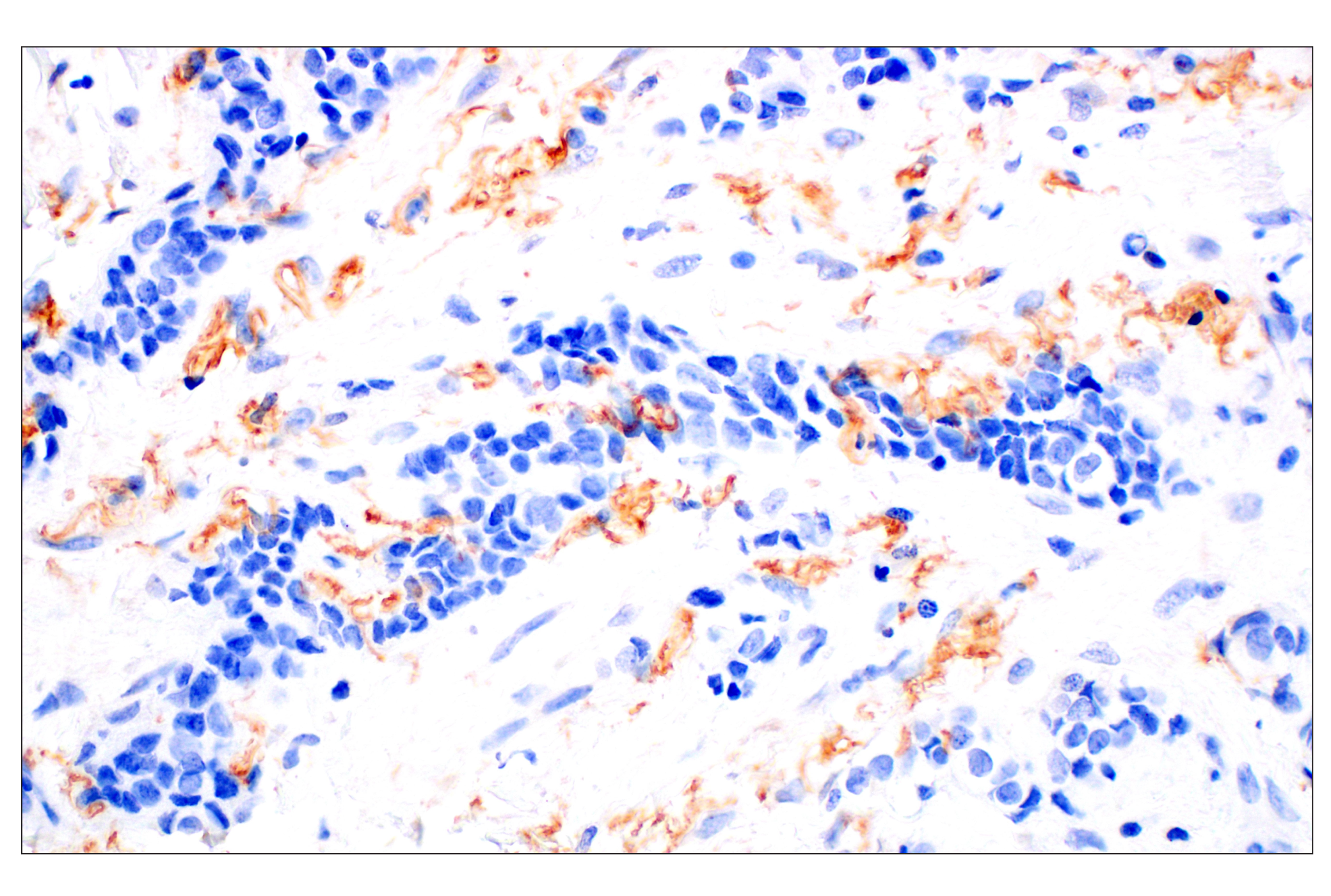 Immunohistochemistry Image 3: Neuropilin-2 (E5Q2G) Rabbit mAb (BSA and Azide Free)