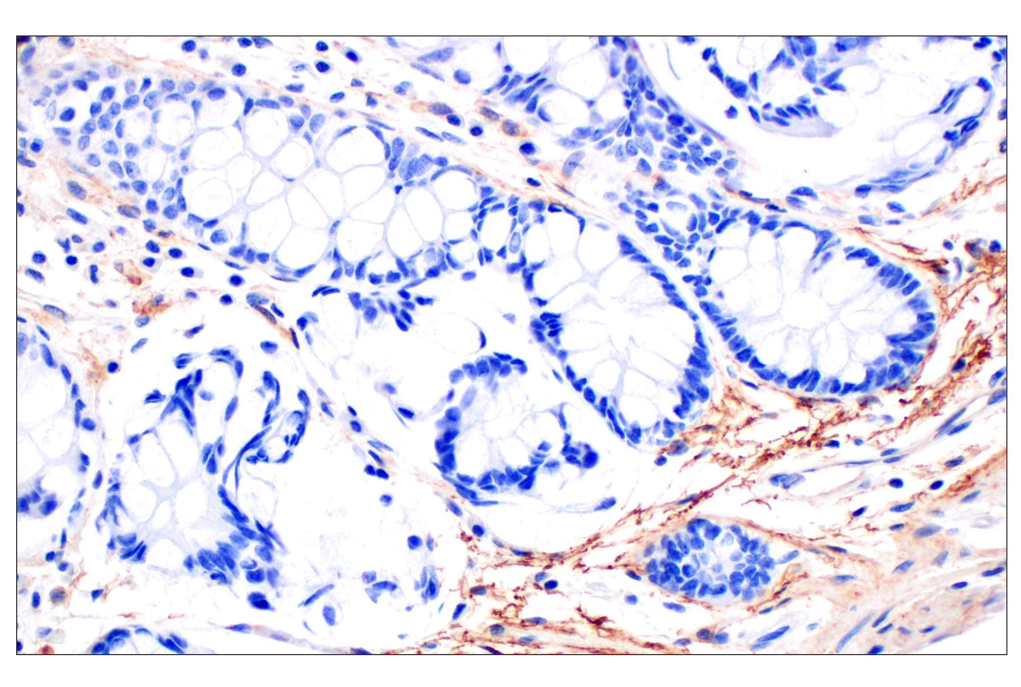 Immunohistochemistry Image 5: Neuropilin-2 (E5Q2G) Rabbit mAb (BSA and Azide Free)