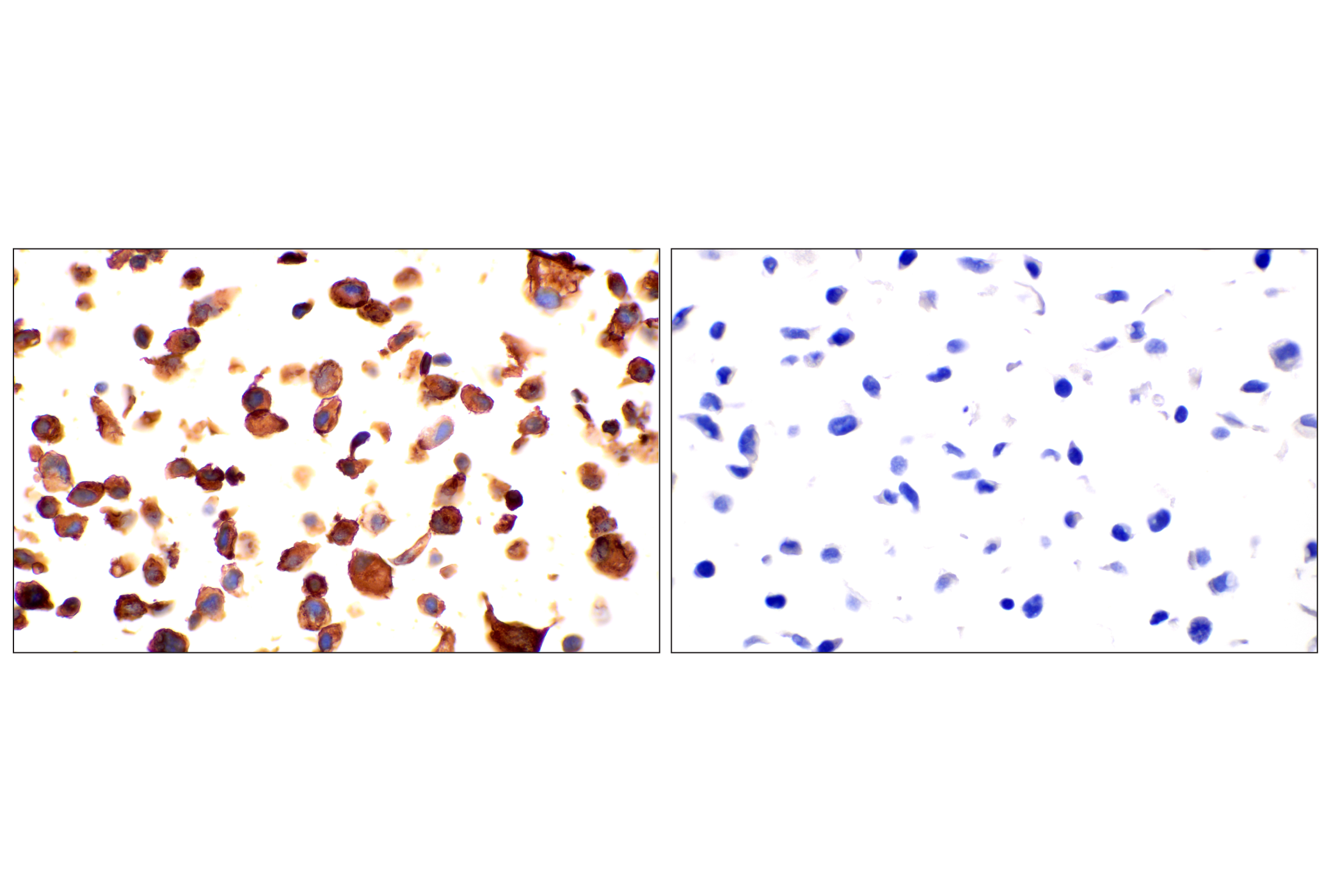 Immunohistochemistry Image 11: Neuropilin-2 (E5Q2G) Rabbit mAb (BSA and Azide Free)