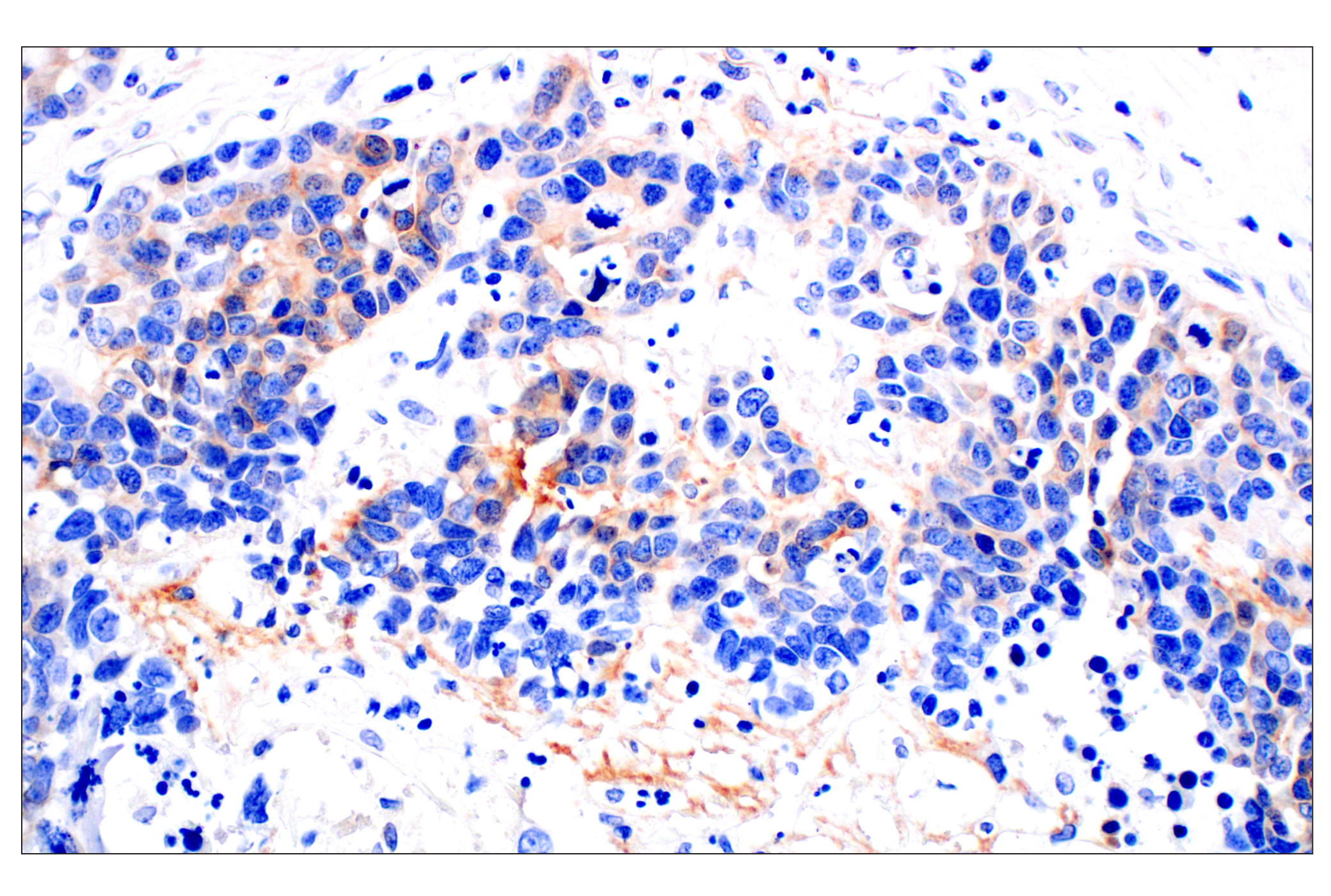 Immunohistochemistry Image 2: Neuropilin-2 (E5Q2G) Rabbit mAb (BSA and Azide Free)