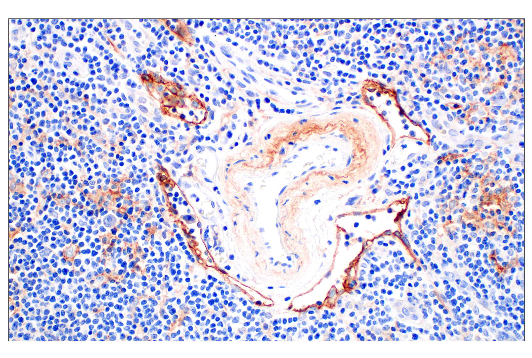 Immunohistochemistry Image 1: Neuropilin-2 (E5Q2G) Rabbit mAb (BSA and Azide Free)