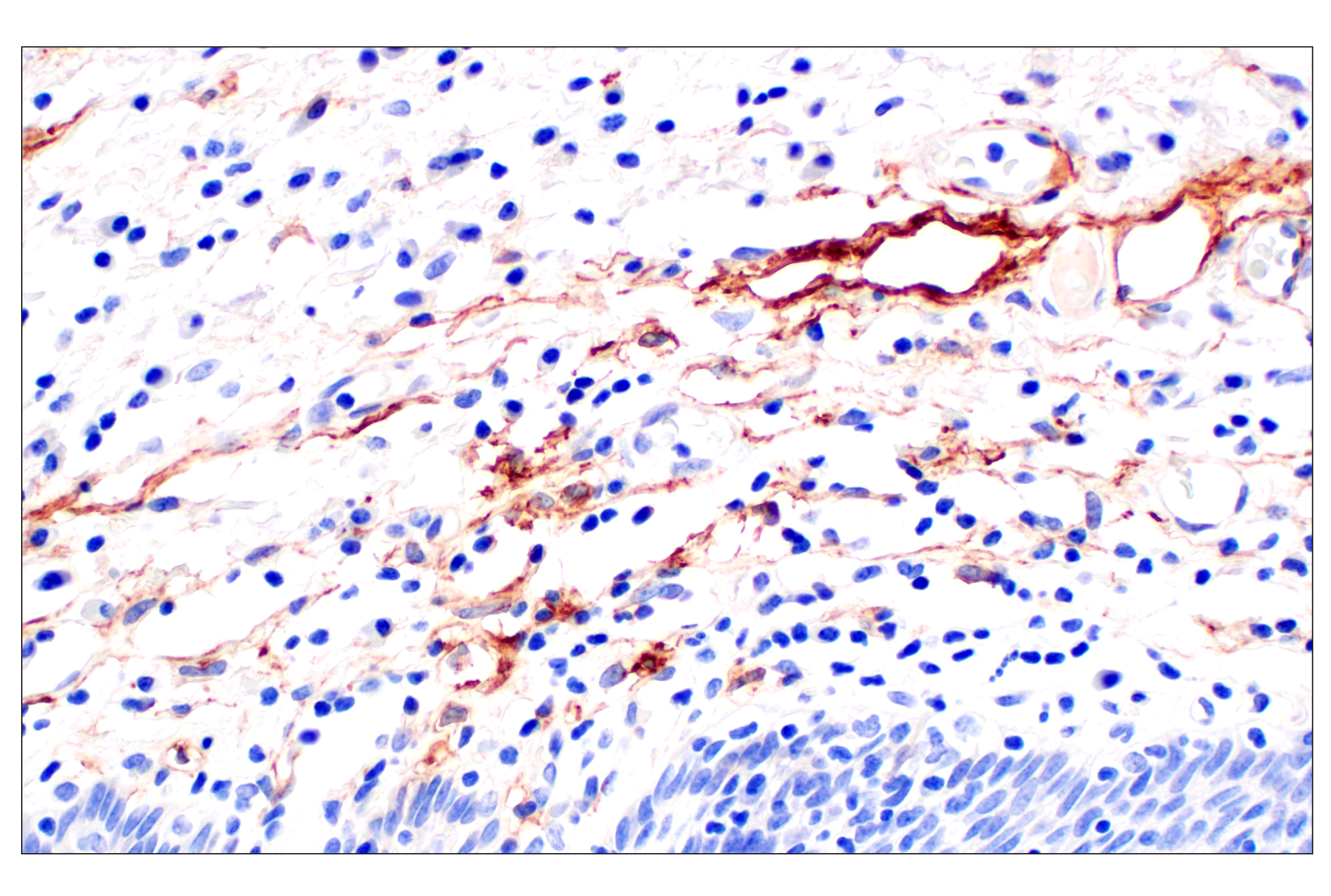 Immunohistochemistry Image 9: Neuropilin-2 (E5Q2G) Rabbit mAb (BSA and Azide Free)