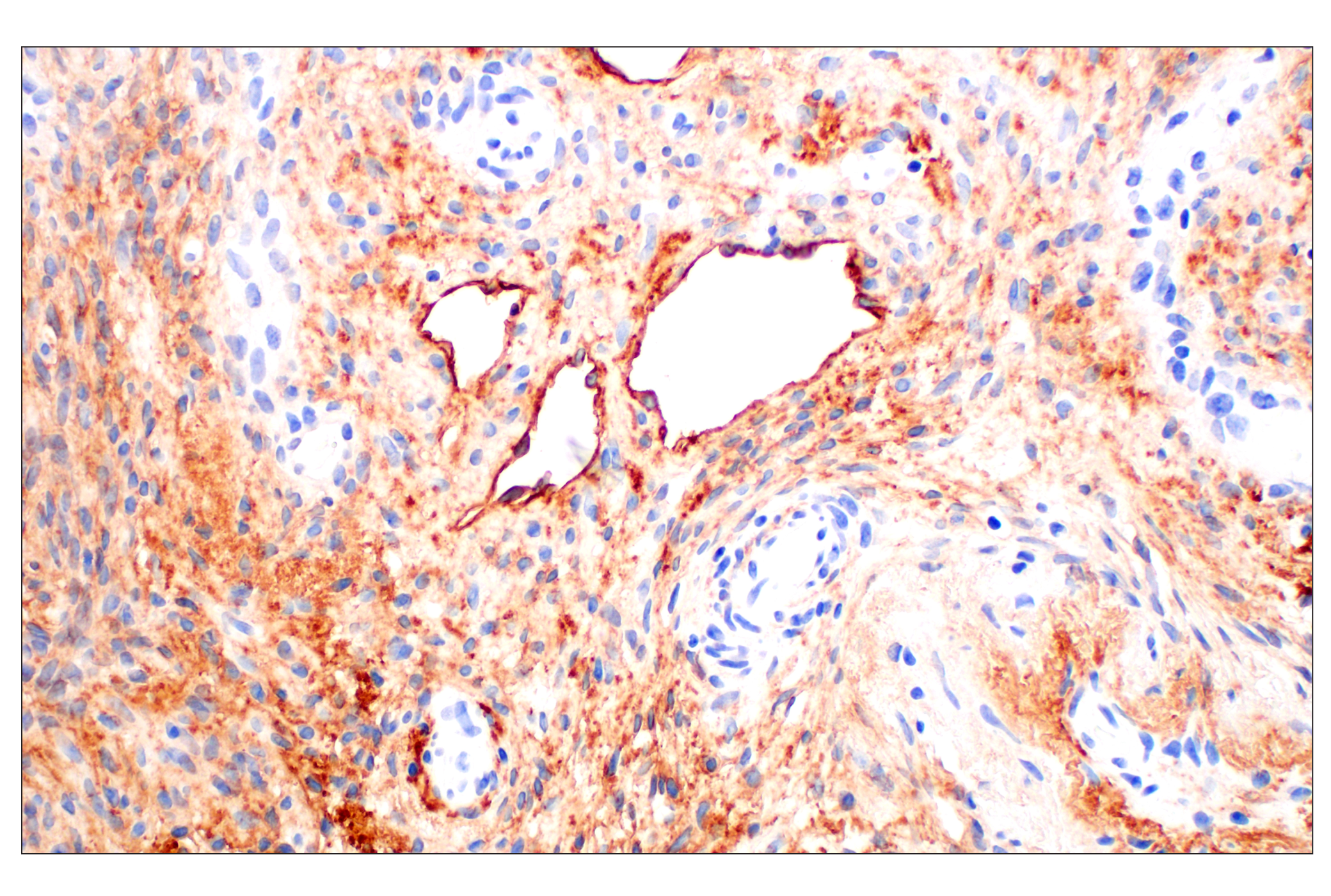 Immunohistochemistry Image 8: Neuropilin-2 (E5Q2G) Rabbit mAb (BSA and Azide Free)