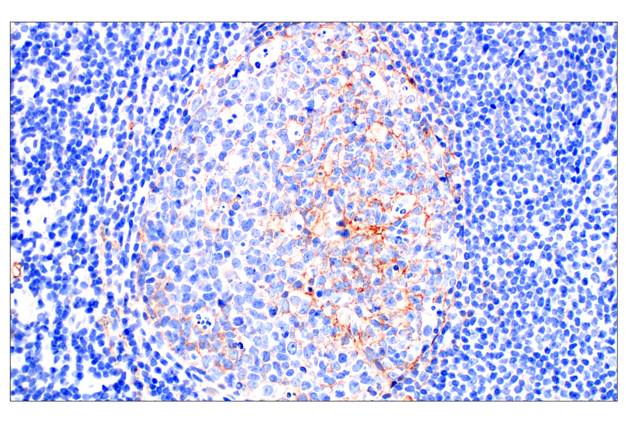 Immunohistochemistry Image 7: Neuropilin-2 (E5Q2G) Rabbit mAb (BSA and Azide Free)